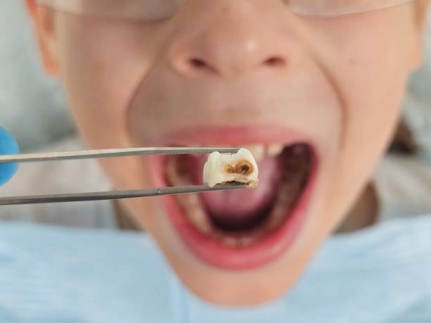 Best Urgent Tooth Repair  in Deerfield, IL